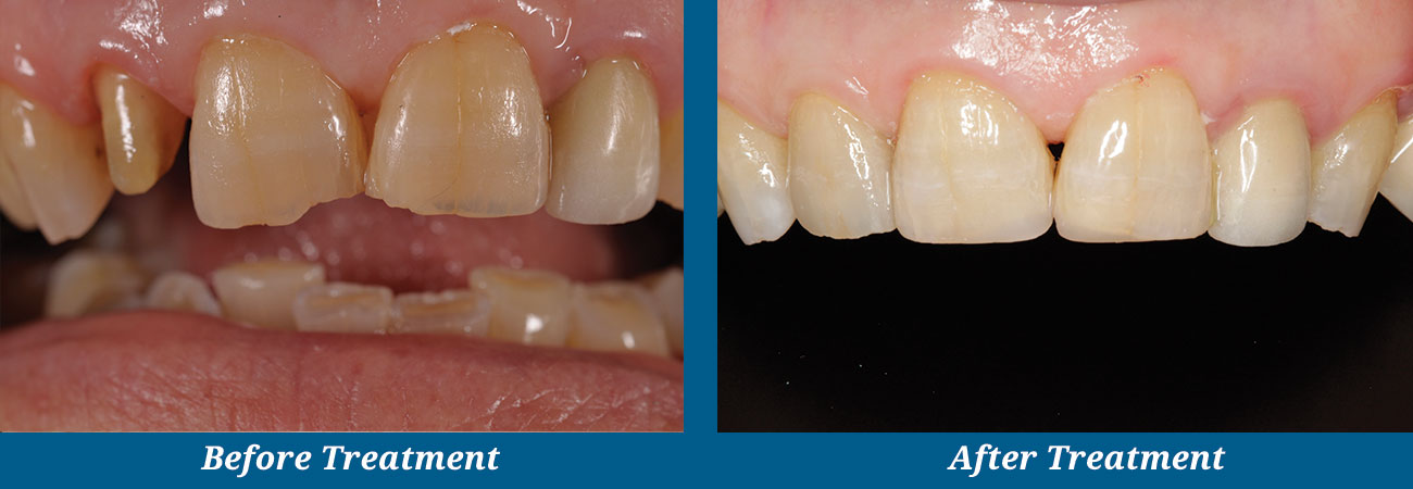 rockplazadental-before-after-10