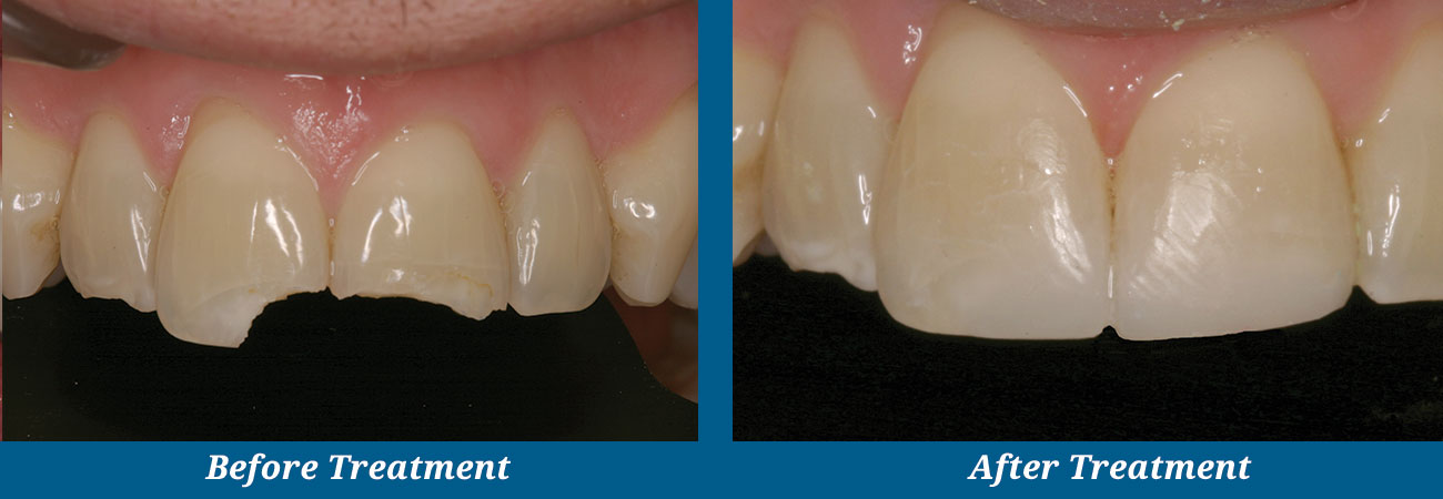 rockplazadental-before-after-12