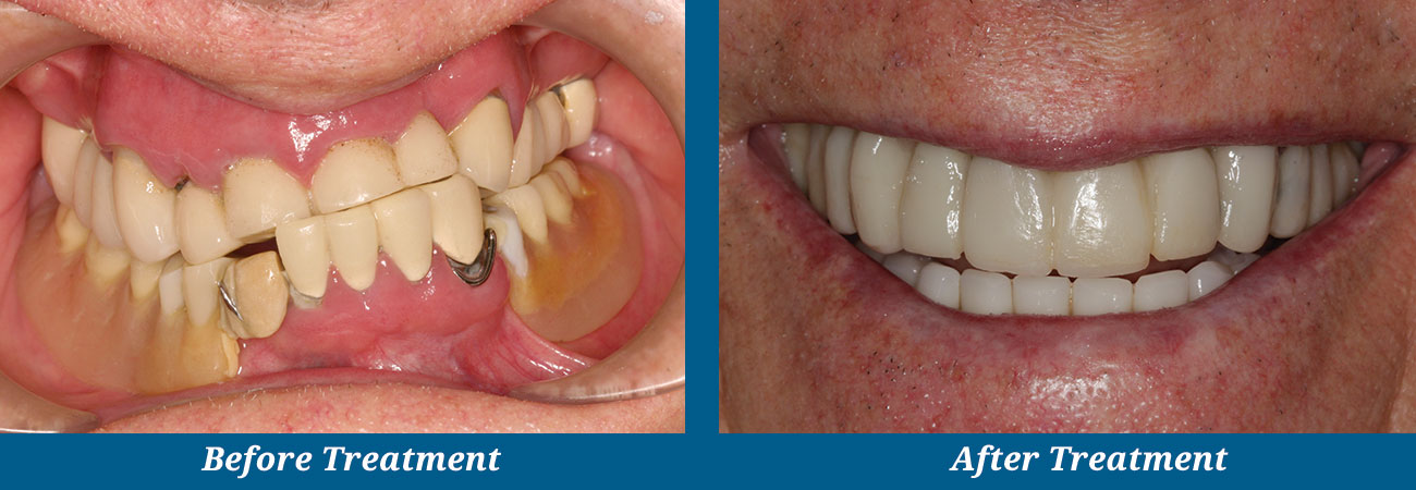 rockplazadental-before-after-15
