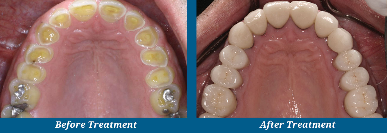 rockplazadental-before-after-17