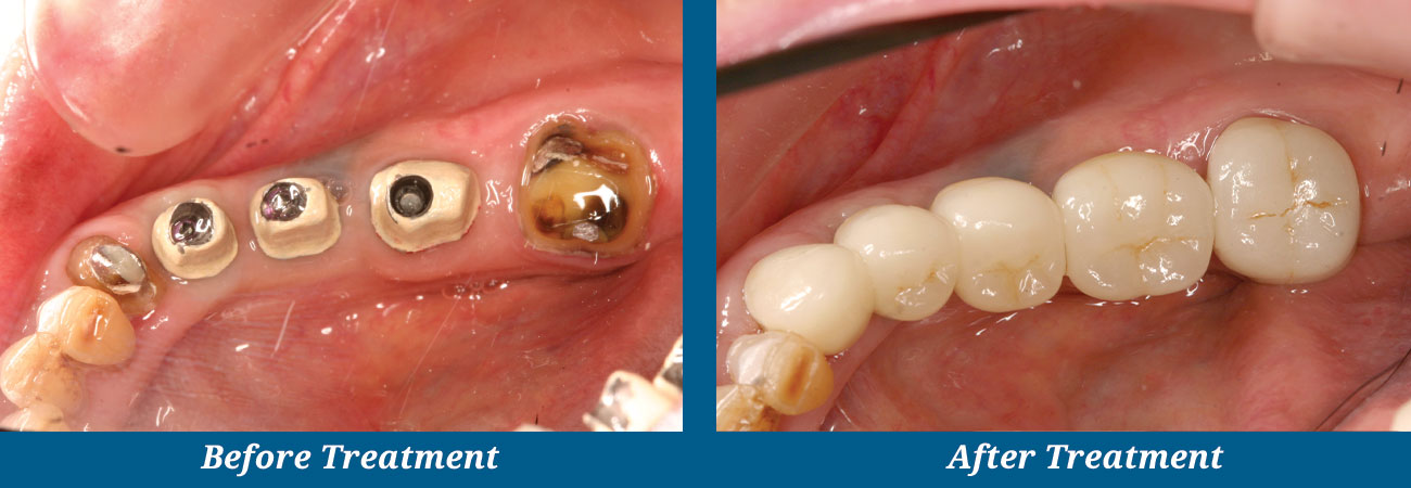 rockplazadental-before-after-19