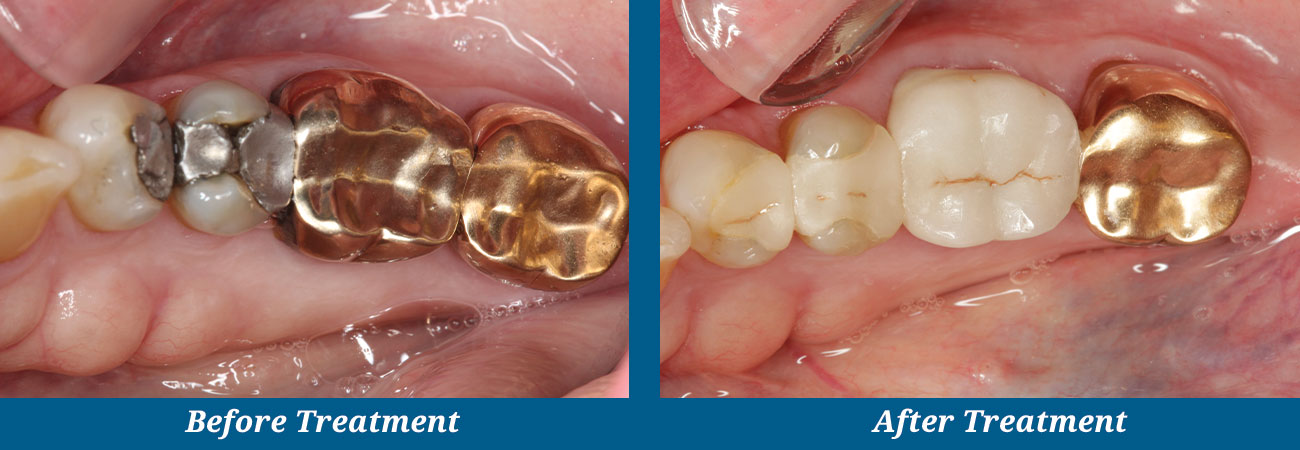 rockplazadental-before-after-20