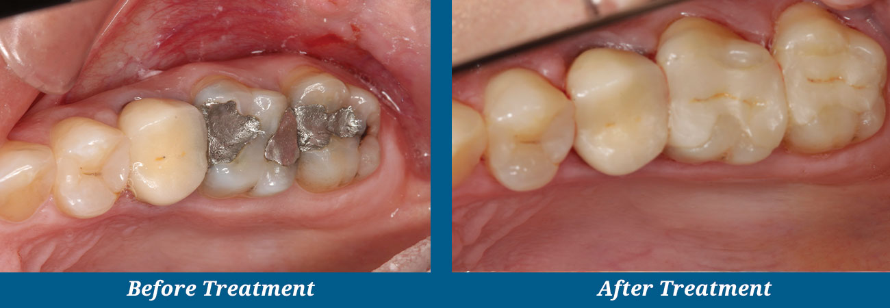 rockplazadental-before-after-21