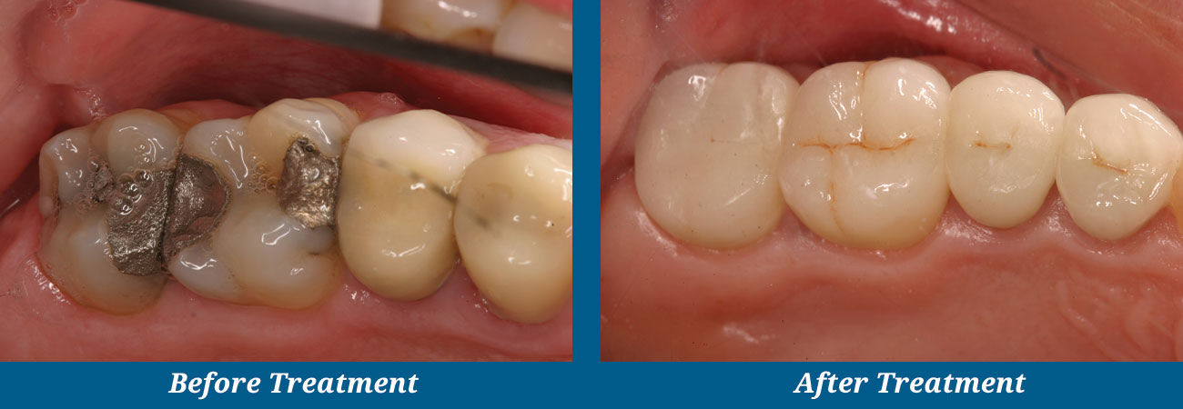 rockplazadental-before-after-22