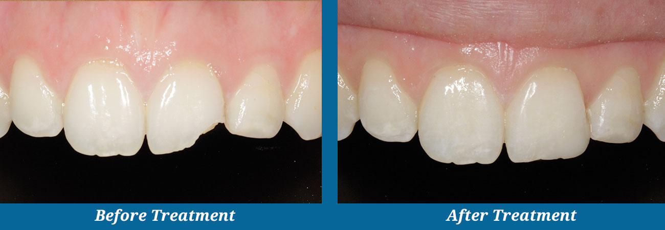 rockplazadental-before-after-23