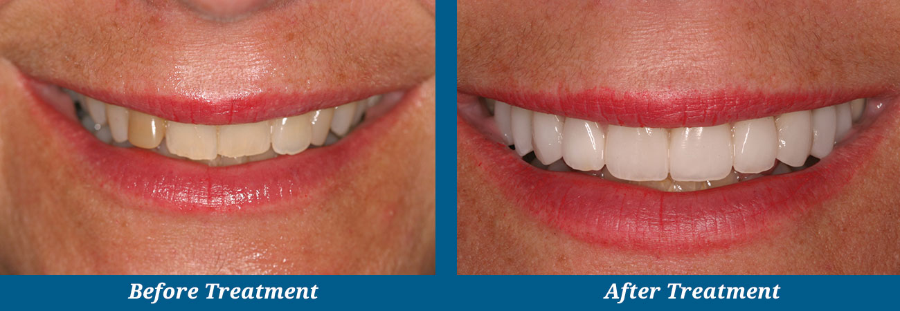 rockplazadental-before-after-3