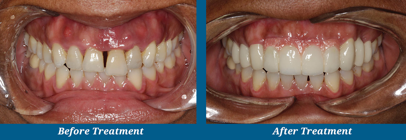 rockplazadental-before-after-5