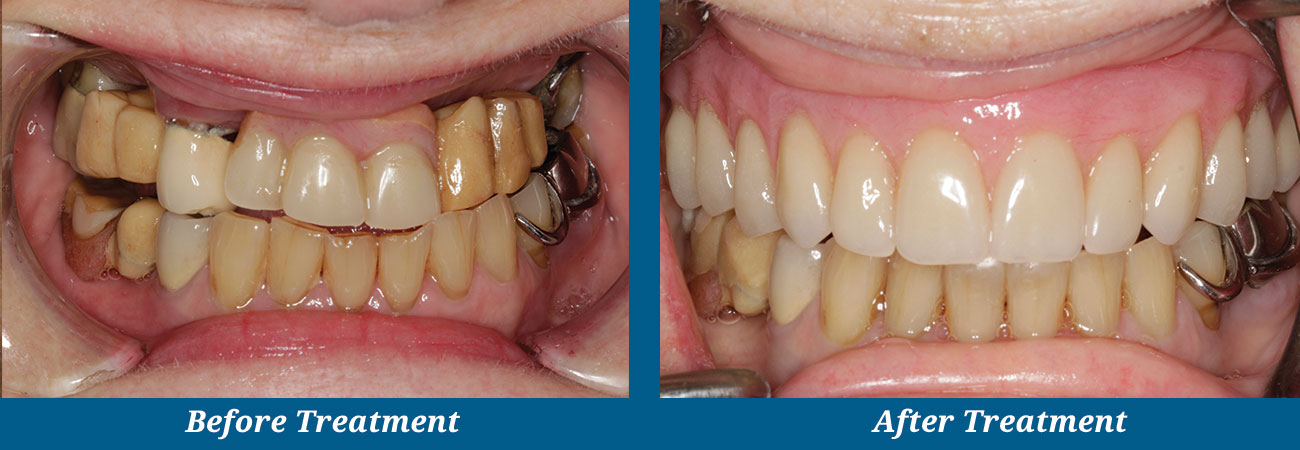 rockplazadental-before-after-9